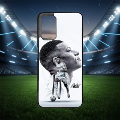 Champions Edition - Mbappe - Xiaomi tok 