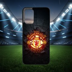 Champions Edition - Manchester United - Xiaomi tok 